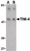T Cell Immunoglobulin And Mucin Domain Containing 4 antibody, PA5-20247, Invitrogen Antibodies, Western Blot image 