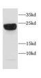 Calcyphosine Like antibody, FNab01254, FineTest, Western Blot image 