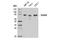 Coilin antibody, 14168S, Cell Signaling Technology, Western Blot image 