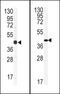 Gap Junction Protein Alpha 1 antibody, 58-174, ProSci, Western Blot image 