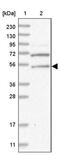 Endoplasmic Reticulum Lectin 1 antibody, PA5-56762, Invitrogen Antibodies, Western Blot image 