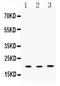 Anterior Gradient 2, Protein Disulphide Isomerase Family Member antibody, A02922-2, Boster Biological Technology, Western Blot image 
