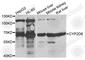 Cytochrome P450 Family 2 Subfamily D Member 6 antibody, A1299, ABclonal Technology, Western Blot image 