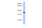 Ribosomal Protein Lateral Stalk Subunit P0 antibody, GTX47427, GeneTex, Western Blot image 