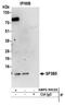 Splicing Factor 3b Subunit 5 antibody, NBP2-59132, Novus Biologicals, Immunoprecipitation image 
