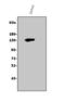 Thrombospondin 1 antibody, A00667-2, Boster Biological Technology, Western Blot image 