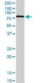 Bromodomain Containing 3 antibody, LS-C133531, Lifespan Biosciences, Western Blot image 