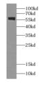 G Protein-Coupled Receptor 101 antibody, FNab03587, FineTest, Western Blot image 