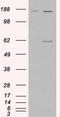 Monoamine Oxidase A antibody, EB06928, Everest Biotech, Western Blot image 