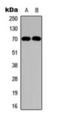 Neurofibromin 2 antibody, orb393120, Biorbyt, Western Blot image 