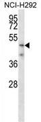 Transmembrane Serine Protease 5 antibody, AP54301PU-N, Origene, Western Blot image 
