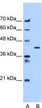 Adipocyte Plasma Membrane Associated Protein antibody, TA338424, Origene, Western Blot image 