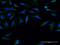 Formin 1 antibody, MA5-24537, Invitrogen Antibodies, Immunofluorescence image 