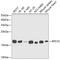 Ribosomal Protein S10 antibody, A5880, ABclonal Technology, Western Blot image 