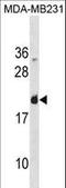 Galectin 7B antibody, LS-C157861, Lifespan Biosciences, Western Blot image 