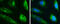Metadherin antibody, GTX130679, GeneTex, Immunofluorescence image 
