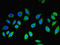 Melan-A antibody, LS-C377554, Lifespan Biosciences, Immunofluorescence image 