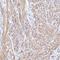 Tropomyosin 1 antibody, NBP1-89896, Novus Biologicals, Immunohistochemistry paraffin image 