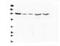 Calcium Sensing Receptor antibody, M00574, Boster Biological Technology, Western Blot image 