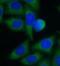 Solute Carrier Family 25 Member 1 antibody, FNab07927, FineTest, Immunofluorescence image 