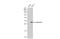 Galectin 3 antibody, GTX635151, GeneTex, Western Blot image 