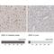 Zinc Finger E-Box Binding Homeobox 1 antibody, NBP1-88845, Novus Biologicals, Immunohistochemistry paraffin image 