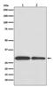 BCL2 Interacting Protein 3 antibody, M01469, Boster Biological Technology, Western Blot image 