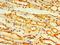 Ectodysplasin A2 Receptor antibody, LS-C379862, Lifespan Biosciences, Immunohistochemistry paraffin image 