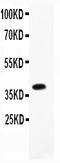 Transient Receptor Potential Cation Channel Subfamily V Member 1 antibody, RP1030, Boster Biological Technology, Western Blot image 