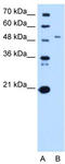 Serine Palmitoyltransferase Long Chain Base Subunit 1 antibody, TA339044, Origene, Western Blot image 