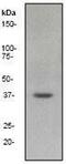 Mitogen-Activated Protein Kinase Kinase 6 antibody, GTX61432, GeneTex, Western Blot image 