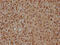 ADP Ribosylation Factor Like GTPase 2 Binding Protein antibody, CSB-PA897097HA01HU, Cusabio, Immunohistochemistry paraffin image 