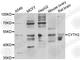 Cytohesin 2 antibody, A7035, ABclonal Technology, Western Blot image 