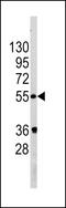 Golgi Associated PDZ And Coiled-Coil Motif Containing antibody, LS-C100821, Lifespan Biosciences, Western Blot image 