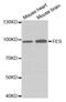 FES Proto-Oncogene, Tyrosine Kinase antibody, MBS126494, MyBioSource, Western Blot image 