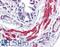 Actin Alpha 1, Skeletal Muscle antibody, LS-B4203, Lifespan Biosciences, Immunohistochemistry paraffin image 