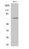 Paxillin antibody, STJ90380, St John