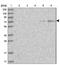 Cytochrome P450 Family 1 Subfamily B Member 1 antibody, NBP1-85496, Novus Biologicals, Western Blot image 