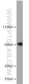 Telomeric Repeat Binding Factor 2 antibody, 22020-1-AP, Proteintech Group, Western Blot image 