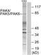 P21 (RAC1) Activated Kinase 4 antibody, PA5-38382, Invitrogen Antibodies, Western Blot image 