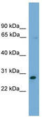 Zinc Finger Protein 37A antibody, TA342396, Origene, Western Blot image 