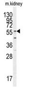 Glutamate Decarboxylase Like 1 antibody, AP17409PU-N, Origene, Western Blot image 
