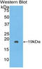 Serpin Family A Member 10 antibody, LS-C296137, Lifespan Biosciences, Western Blot image 