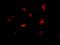 Metastasis Associated 1 Family Member 2 antibody, A03073, Boster Biological Technology, Immunofluorescence image 