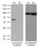 RAD23 Homolog B, Nucleotide Excision Repair Protein antibody, LS-C790417, Lifespan Biosciences, Western Blot image 