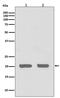 Interleukin 1 Receptor Antagonist antibody, M00651, Boster Biological Technology, Western Blot image 