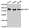 EPS8 Like 2 antibody, MBS129717, MyBioSource, Western Blot image 