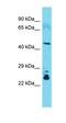 Cytohesin 1 Interacting Protein antibody, orb331183, Biorbyt, Western Blot image 