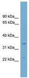 Vestigial Like Family Member 2 antibody, TA329594, Origene, Western Blot image 