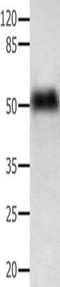 Acid Phosphatase, Prostate antibody, orb518306, Biorbyt, Western Blot image 